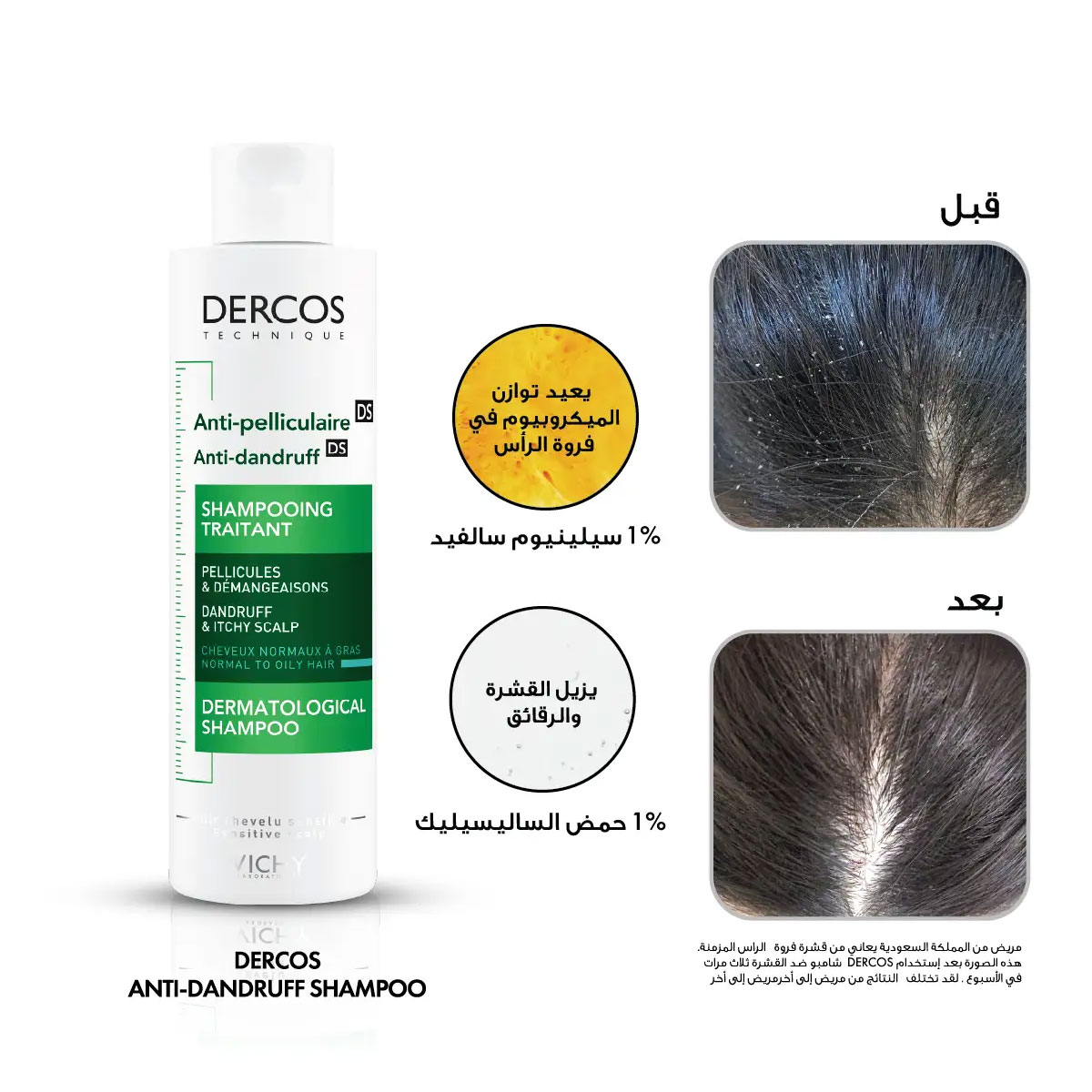 Vichy Dercos Anti Dandruff Shampoo 200 Ml