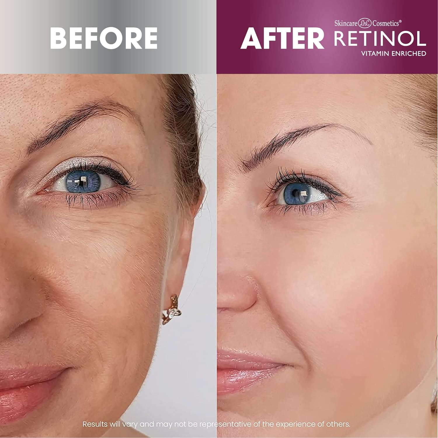 Retinol -advanced Skin Brightening Serum